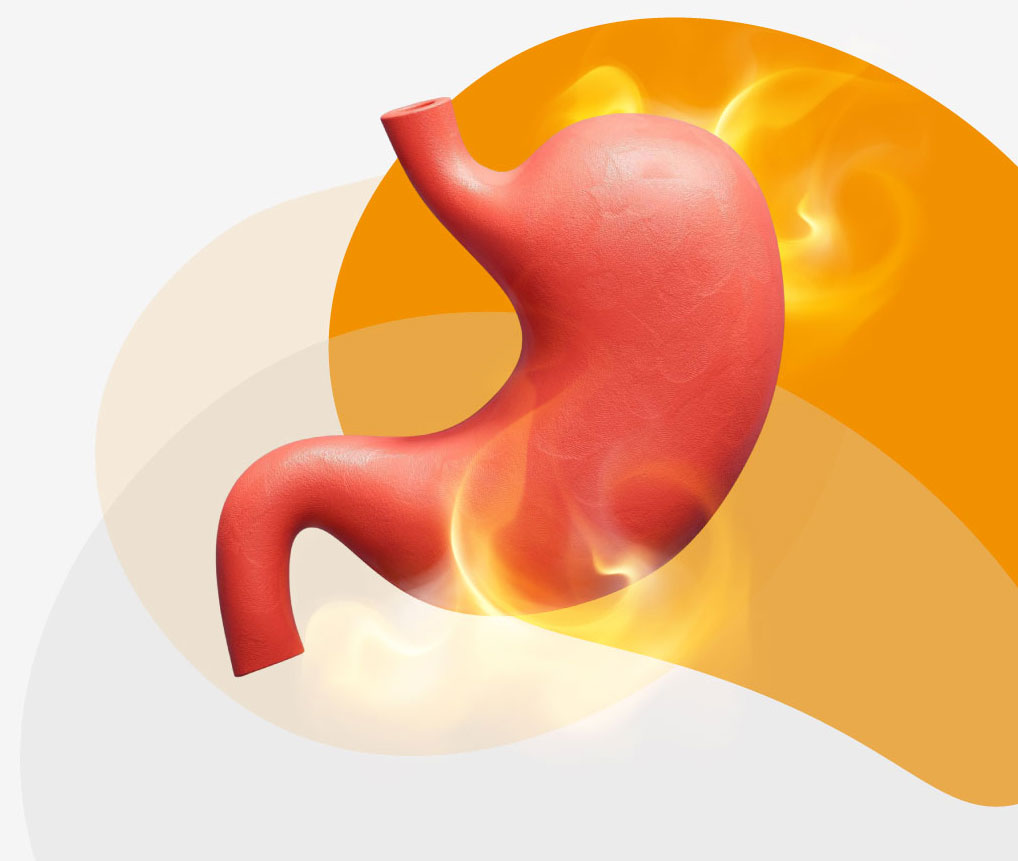 Protocolo de Investigación: Dispepsia
